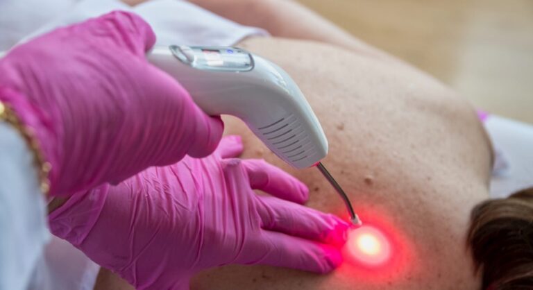 Laserterapia